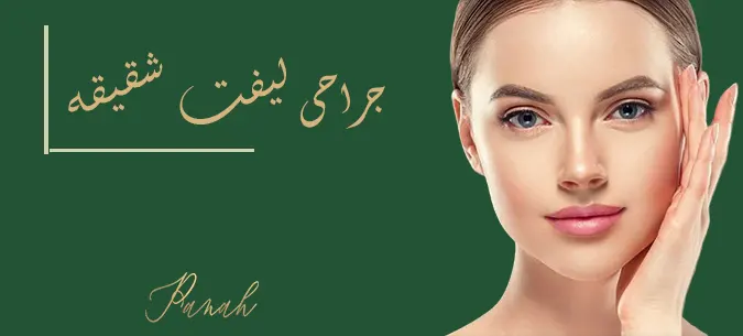 عمل لیفت شقیقه