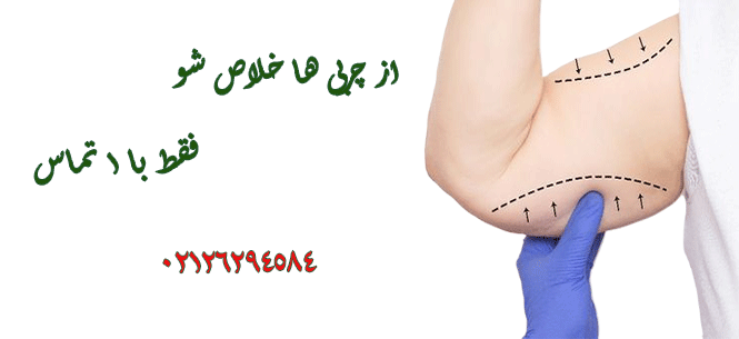 عمل لیپوساکشن بازو