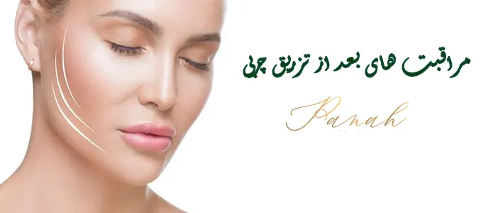 مراقبت های بعد از تزریق چربی به صورت