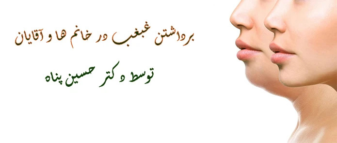 جراحی برداشتن غبغب