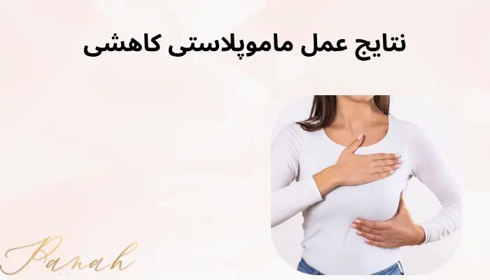 نتایج عمل ماموپلاستی کاهشی نتایج عمل ماموپلاستی کاهشی