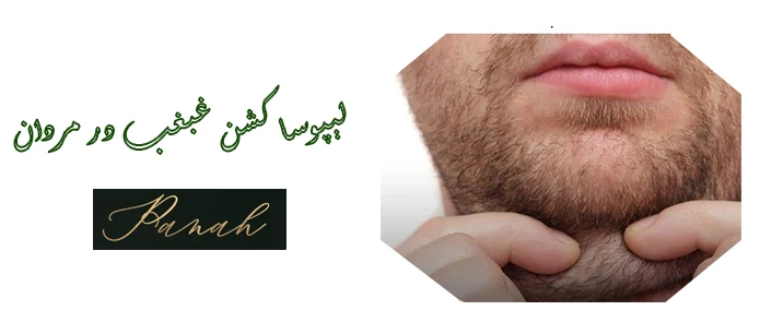 لیپوساکشن غبغب در آقایان