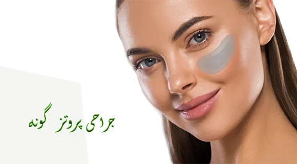 جراحی پروتز گونه جراحی پروتز گونه