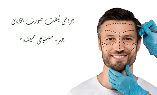 عمل لیفت صورت اقایان