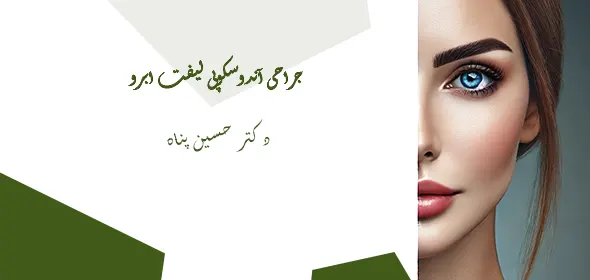 لیفت اندوسکوپیک پیشانی