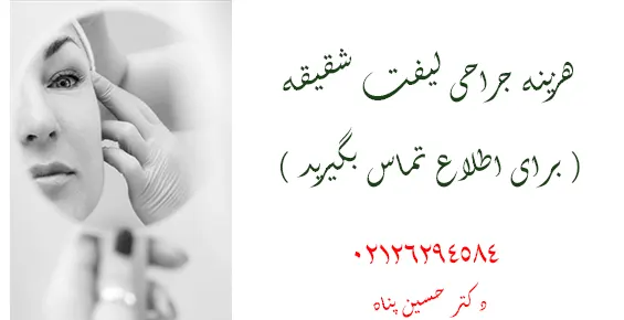 هزینه جراحی لیفت شقیقه هزینه جراحی لیفت شقیقه