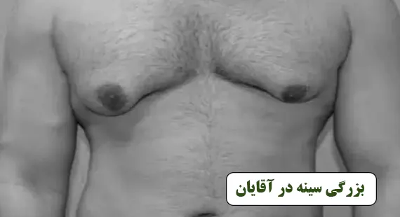 بزرگی سینه اقایان بزرگی سینه اقایان