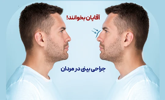 جراحی بینی در مردان