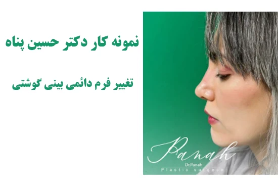 جراحی بینی گوشتی جراحی بینی گوشتی