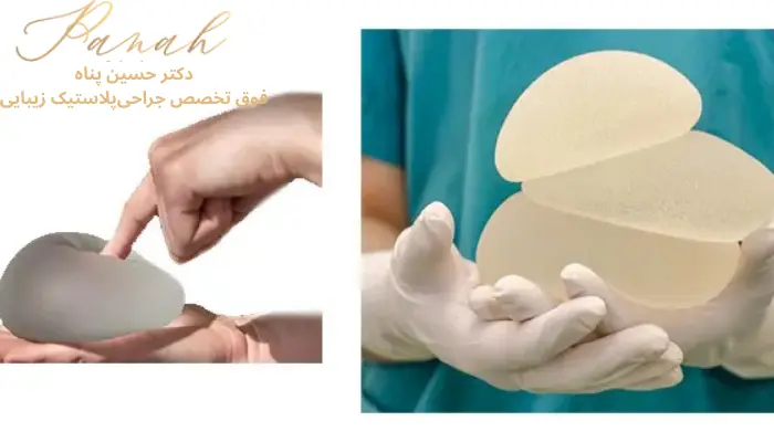 ویژگی و مزایای عمل پروتز سینه