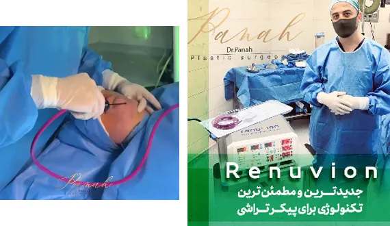 رنووین در تهران رنووین در تهران