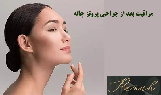 مراقبت بعد از عمل چانه