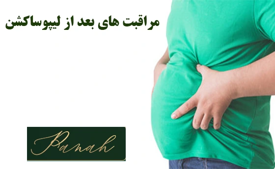 مراقبت های بعد از لیپوساکشن مراقبت های بعد از لیپوساکشن