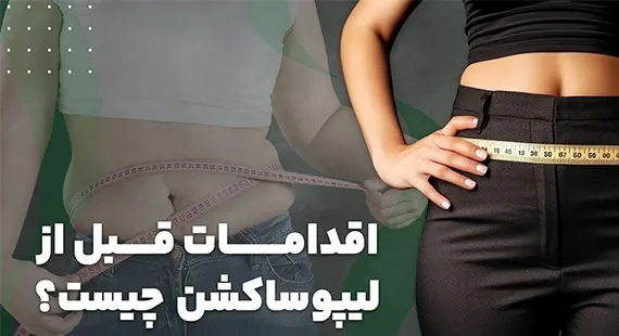 نکات قبل از لیپوساکشن