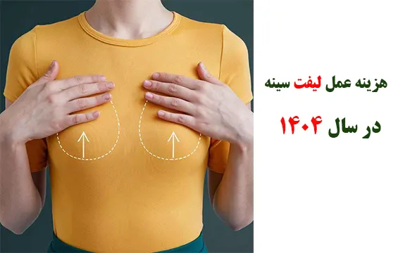 هزینه عمل لیفت سینه 1404 هزینه عمل لیفت سینه 1404