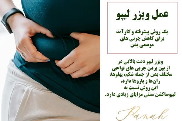 عمل ویزر لیپو عمل ویزر لیپو